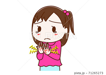 両手の手荒れが酷くてヒリヒリ痛い少女 71265273