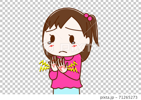 両手の手荒れが酷くてヒリヒリ痛い少女 71265273