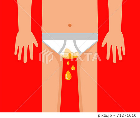 man in shorts pissing. urinary incontinence disease.  71271610