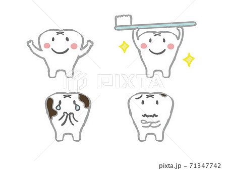歯医者さんで使える歯イラスト4点のイラスト素材