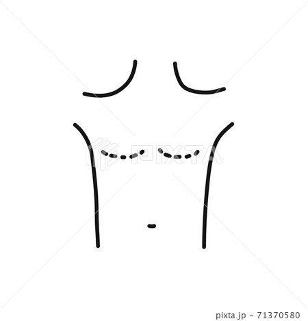 mastectomy doodle icon, vector line illustration mastectomy doodle icon, vector line illustration 71370580
