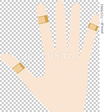 絆創膏だらけの手・指のイラスト 絆創膏だらけの手・指のイラスト 71378901
