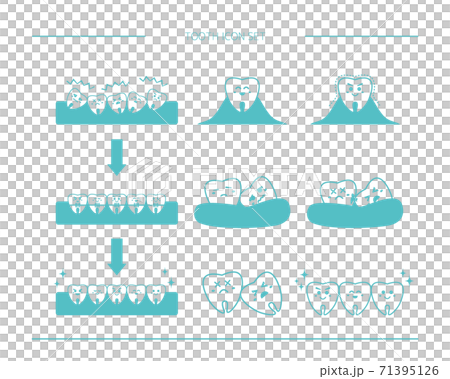 Vector illustration set of teeth Caries orthodontics Vector illustration set of teeth Caries orthodontics 71395126
