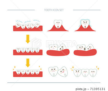 歯のベクターイラストセット 虫歯 歯科矯正のイラスト素材