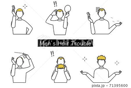 AGA　男性の頭髪トラブル　シチュエーションイラスト 71395600