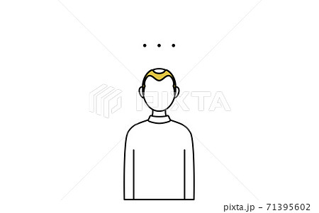 AGAの男性が言葉を失って立ち尽くしているところ AGAの男性が言葉を失って立ち尽くしているところ 71395602