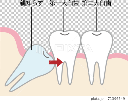 陌生的插圖壓在後牙上 陌生的插圖壓在後牙上 71396349
