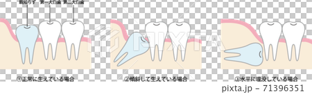 陌生的類型圖 陌生的類型圖 71396351