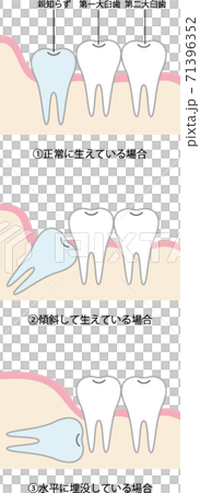 陌生的類型圖 陌生的類型圖 71396352