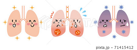 健康な肺と炎症を起こした肺のイラストのイラスト素材