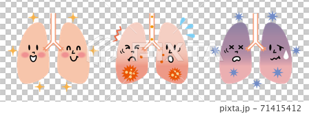 健康な肺と炎症を起こした肺のイラスト 71415412