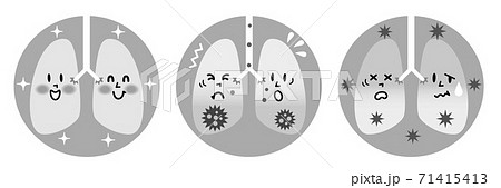 健康な肺と炎症を起こした肺のモノトーンイラスト 71415413
