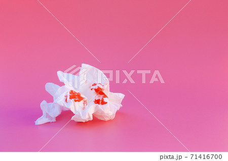Toilet paper and blood. Concept of hemorrhoid treatment. Toilet paper and blood. Concept of hemorrhoid treatment. 71416700