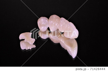 白い歯、きれいな歯で美味しく食べて笑顔に、そして健康に。 71426444