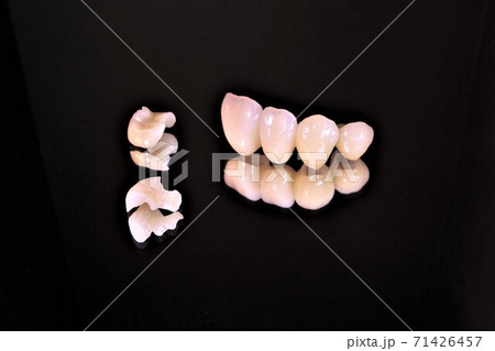 白い歯、きれいな歯で美味しく食べて笑顔に、そして健康に。 71426457