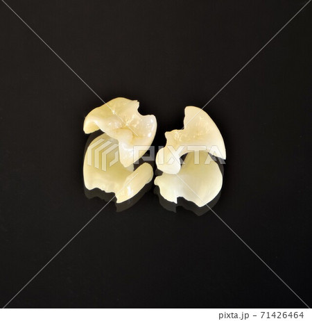 白い歯、きれいな歯で美味しく食べて笑顔に、そして健康に。 71426464