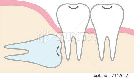 親知らずのイラスト 71426522