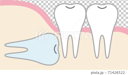 親知らずのイラスト 71426522