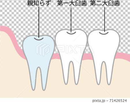 Wisdom tooth illustration - Stock Illustration [71426524] - PIXTA