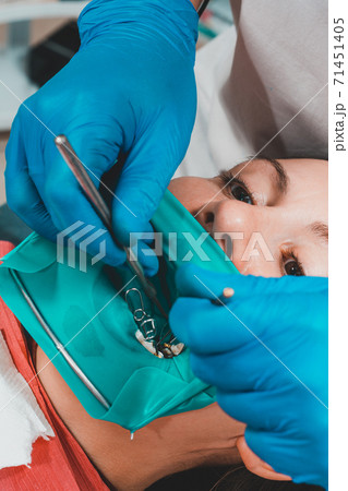 Dental restoration and polymerization of tooth composite materials, the doctor conducts sterile work on tooth restoration. 71451405