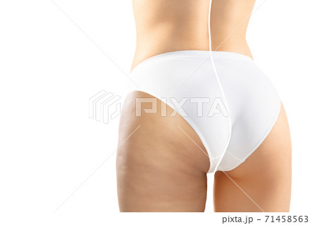 Overweight woman with fat cellulite legs and belly, obesity female body in  white underwear comparing with fit and thin body isolated on white  background Stock Photo by ©vova130555@gmail.com 426920372