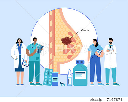 Breast disease concept Breast disease concept 71478714