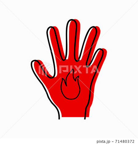 Burn of limbs. Contour silhouette of hand with icon fire and red silhouette on white background. Danger of burns. Vector object 71480372