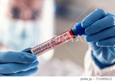 Detail of medical staff holding positive coronavirus test in protective gloves 71489022