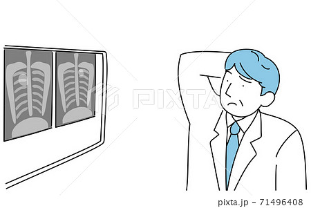 肺のレントゲン写真に写る影を見て頭をかく男性医師 71496408