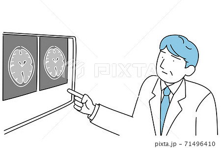 脳のMRI検査で撮った画像を指さす男性医師 脳のMRI検査で撮った画像を指さす男性医師 71496410