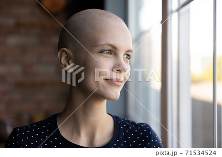 Hopeful millennial woman having oncological disease dreaming near large window Hopeful millennial woman having oncological disease dreaming near large window 71534524