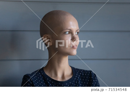 Concentrated young female diagnosed with oncology looking forward with courage Concentrated young female diagnosed with oncology looking forward with courage 71534548