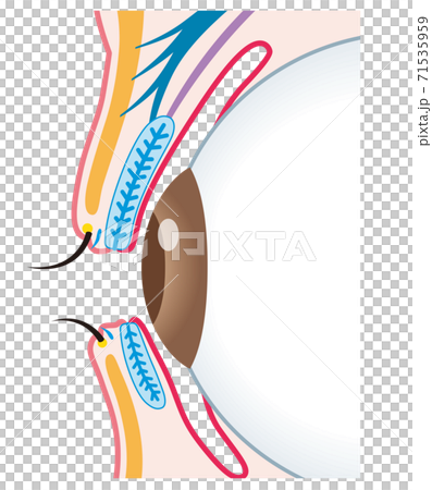 眼瞼結構小麥肉芽腫截面 71535959