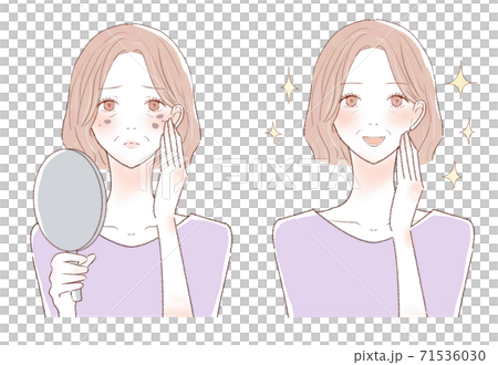シミを気にする中年女性のビフォーアフター 71536030