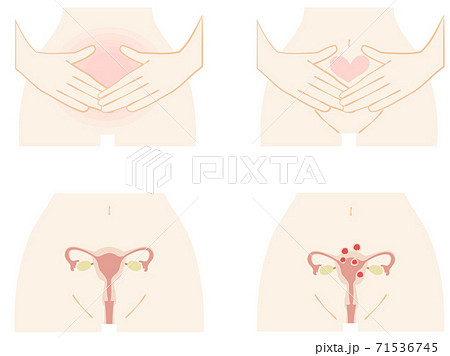 女性の下腹部と子宮のセット 71536745