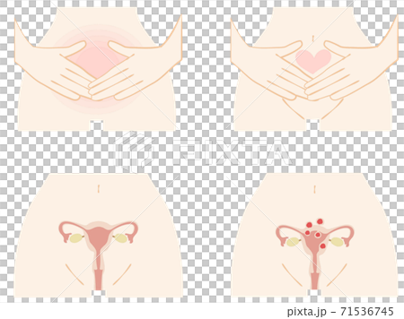 女性小腹和子宮套 71536745