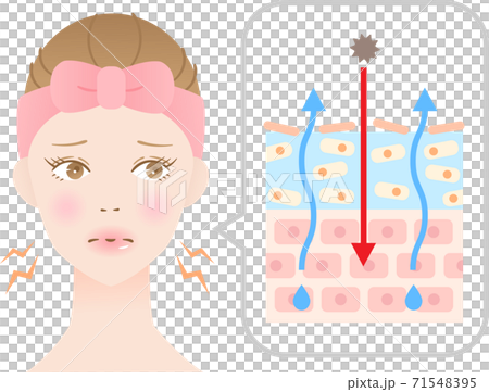 乾燥肌 断面図 女性のイラスト素材