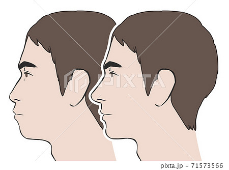 鼻が低い 口が前に出た比較横顔男性のイラスト素材