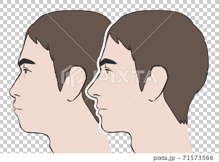 鼻が低い 口が前に出た比較横顔男性のイラスト素材