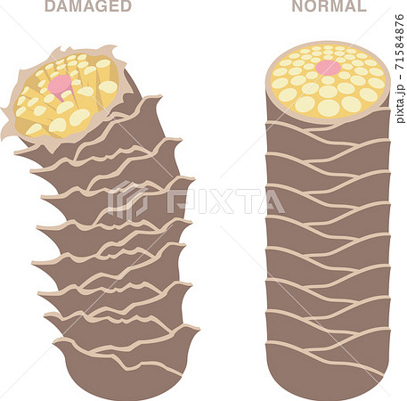 髪の毛の断面図 きれいな髪とダメージヘア のイラスト素材