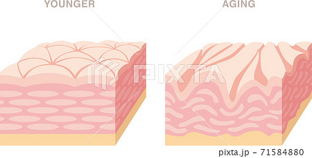 キメが整った肌と荒い肌の断面図 明るい色合いのイラスト のイラスト素材