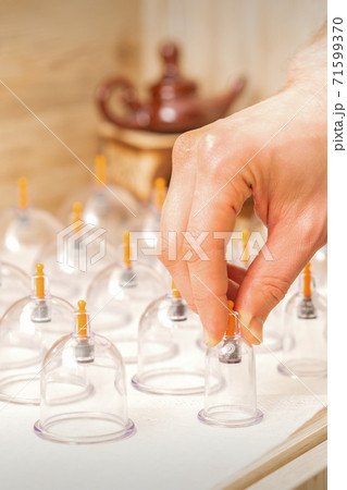 Masseur takes vacuum massage jars 71599370