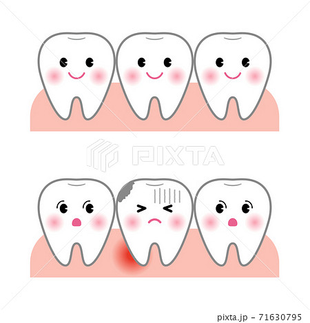 歯のキャラクターセット 健康な白い歯と虫歯で苦しむ歯のイラスト素材