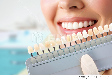 Smiling young woman. Cosmetological teeth whitening in a dental clinic. selection of the tone of the implant tooth Smiling young woman. Cosmetological teeth whitening in a dental clinic. selection of the tone of the implant tooth 71639807