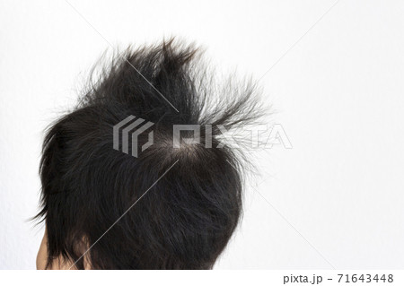 赤ちゃんの髪の毛の寝癖（0歳、生後4か月、女の子） 71643448