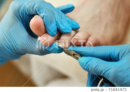 Chiropody. Concept body care. 71681972