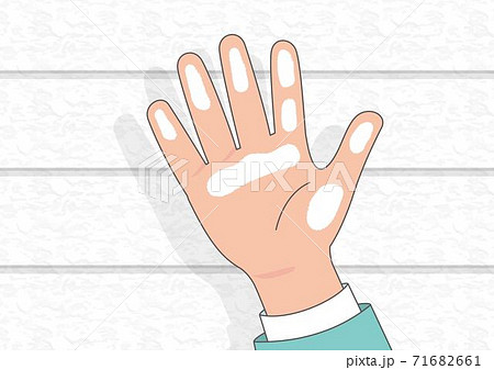 チョーキング現象 住まい 経年劣化 外壁 外壁塗装 劣化 白い粉 塗装 リフォームのイラスト素材