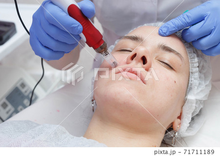 The process of mesotarpia with the introduction of serum under the skin The process of mesotarpia with the introduction of serum under the skin 71711189