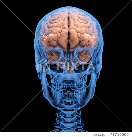 x-ray human skull with brain 71716000