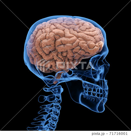 x-ray human skull with brain 71716001